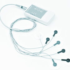 Cardiac Rhythm Monitoring