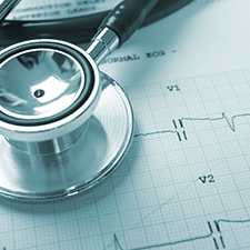 Electrocardiogram (ECG)